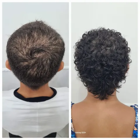 Tricologia