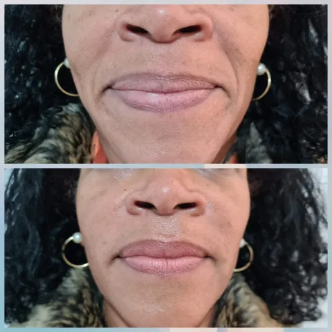 Estética Facial