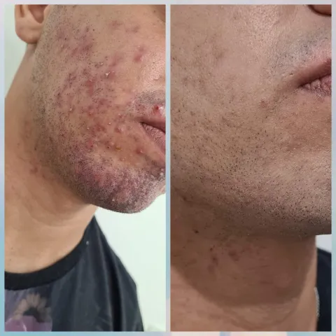 Estética Facial