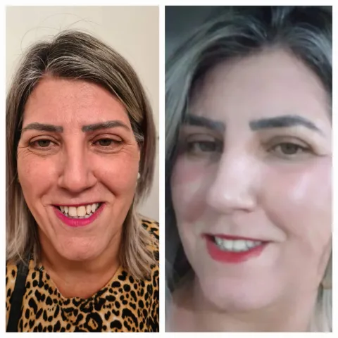 Estética Facial