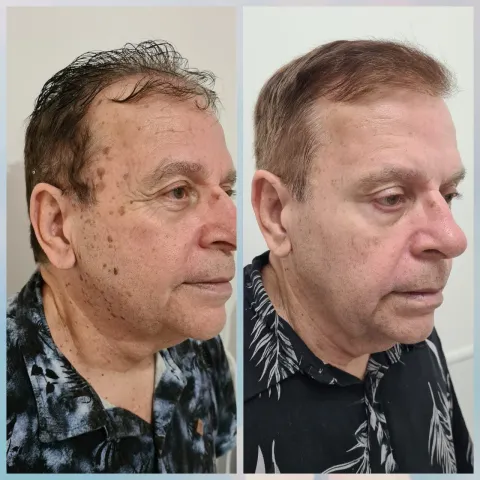 Estética Facial