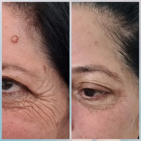 Estética Facial