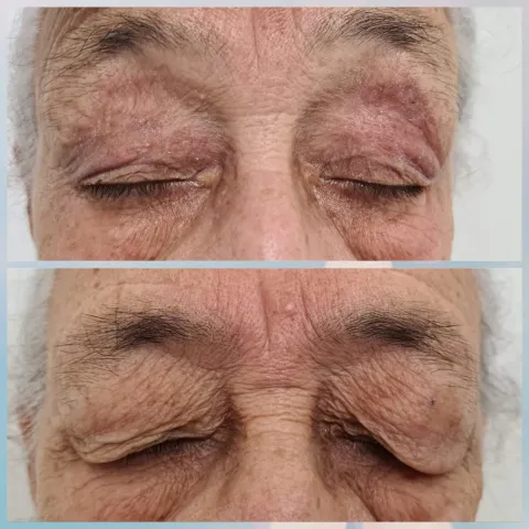 Estética Facial