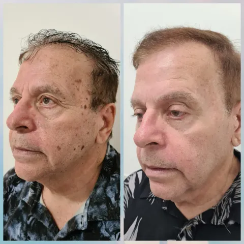 Estética Facial