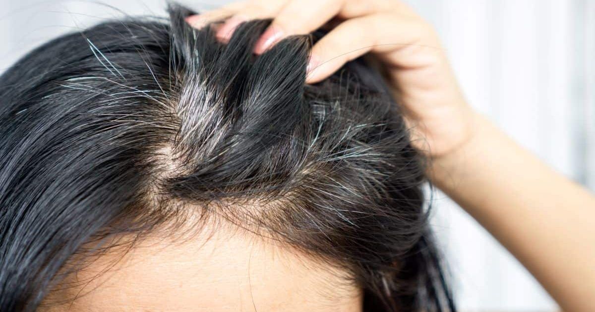 Imagem de capa: Queda de cabelo pode ser um sinal de alerta para a sua saúde