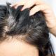 Queda de cabelo pode ser um sinal de alerta para a sua saúde