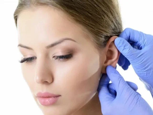 Otoplastia